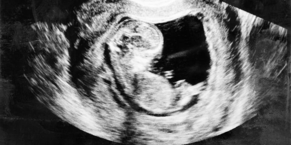 fetus3monthinthewombshutterstock1246820111