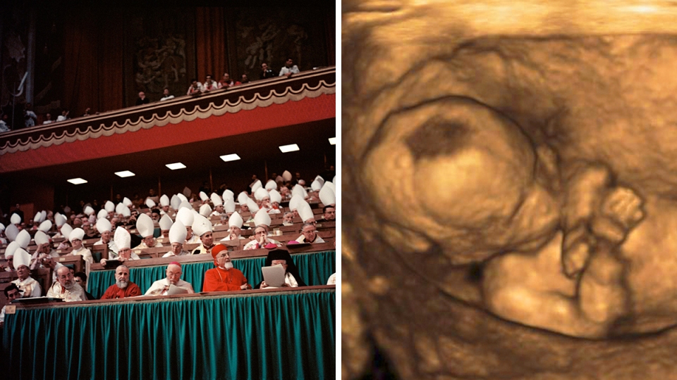 web3secondvaticanultrasoundabortionwikishutterstock